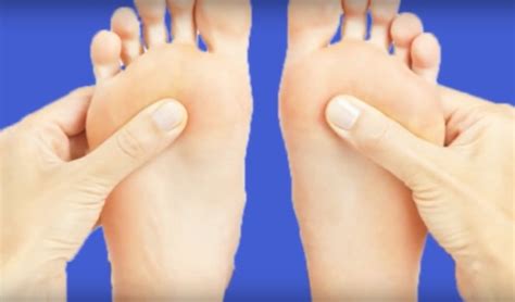 What is Plantar Fibroma? [& How to Treat] - defeetit.com