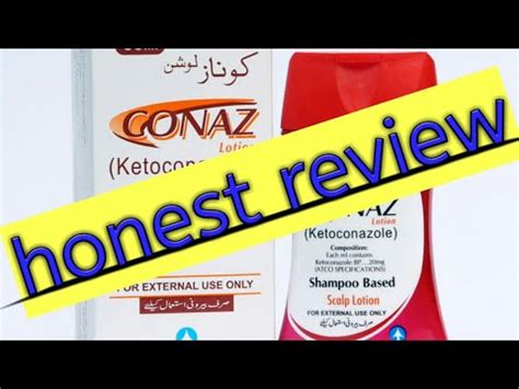 honest review of conaz anti dandruff shampoo || best anti allergy ...