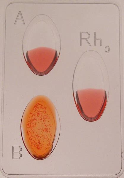 IS3102 Genetics of Blood Types