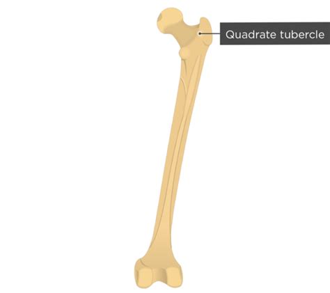 Femur Bone - Posterior Markings