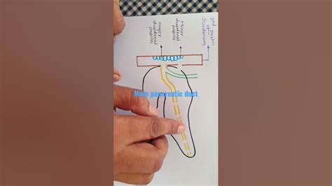 main pancreatic duct, Duct of wirsung , herring bone pattern - YouTube