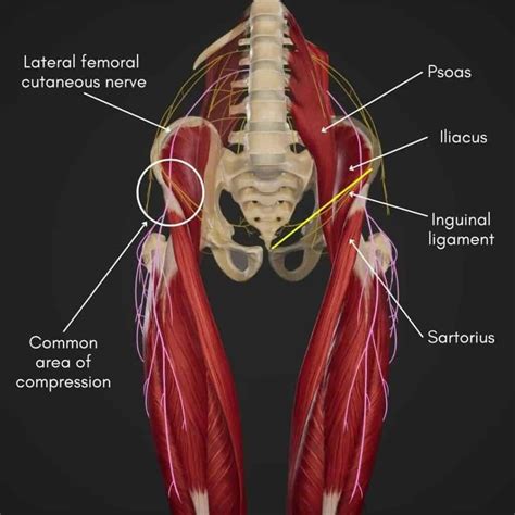 Meralgia Paresthetica: Symptoms, Causes and Sleeping Tips