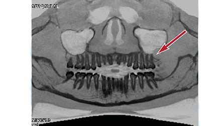 fig-5 - Decisions in Dentistry