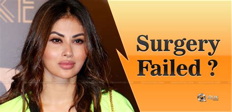 Did Mouni Roy undergo a failed plastic surgery?