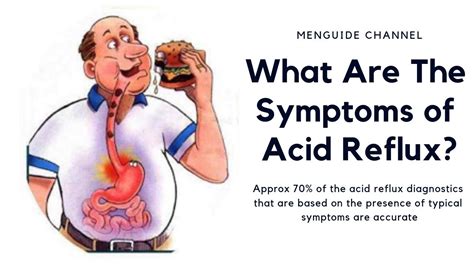 What Are The Symptoms of Acid Reflux - YouTube