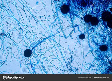 Aspergillus Niger Aspergillus Oryzae Mold Microscope Microbiology Lab — Stock Photo © p ...