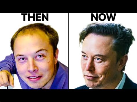 Elon Musk Before & After Hair: Everything You Need To Know!