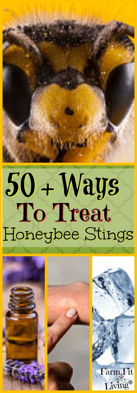 50+ Ways to Treat and Prevent Honey Bee Stings in 2024 | Bee keeping ...