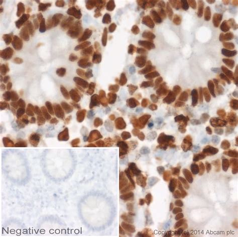 Anti-Histone H1.0 antibody [27] KO Tested (ab11080) | Abcam