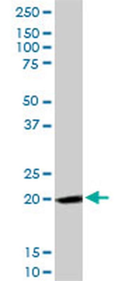 FTH1 Polyclonal Antibody (H00002495-D01P)