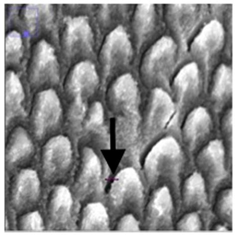 JPM | Free Full-Text | Measuring the Microscopic Structures of Human ...