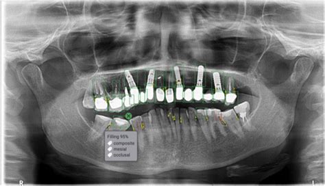 Guide On Utilising Artificial Intelligence (AI) For Oral Diagnosis | DentalReach - Leading ...