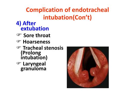 Endotracheal Intubation Complications