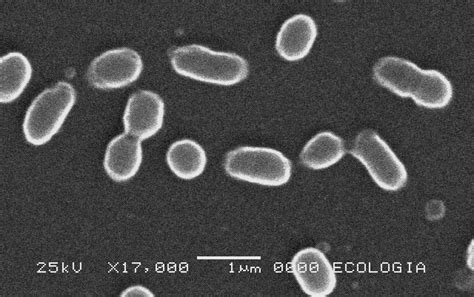 Morphology of the cells of Chryseobacterium sp. under a scanning... | Download Scientific Diagram