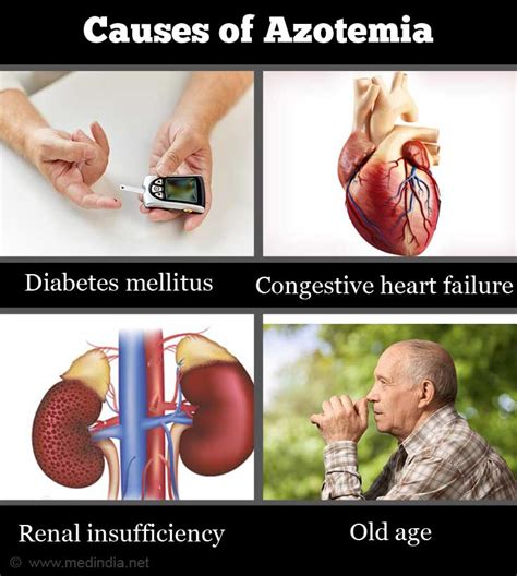 Azotemia (High Blood Nitrogen Levels) - Types, Causes, Symptoms, Diagnosis & Treatment