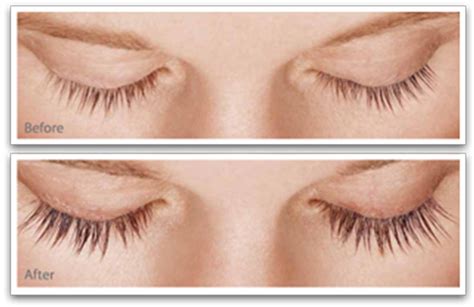 Latisse Eyelash - Jiva Med Spa