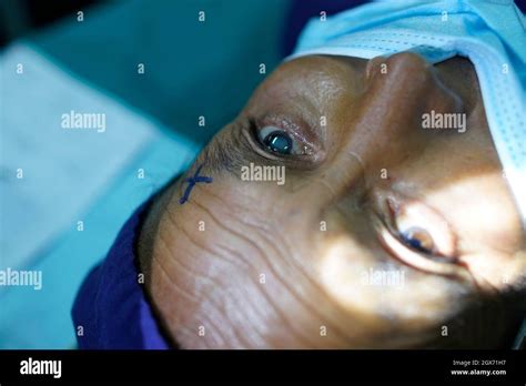 Kathmandu, Nepal. 4th Oct, 2021. A patient waits for a cataract eye surgery inside the operation ...