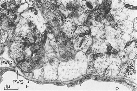 Electromicrograph of the external layer of the median eminence of a rat... | Download Scientific ...