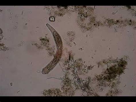 Pond Water Organisms - YouTube