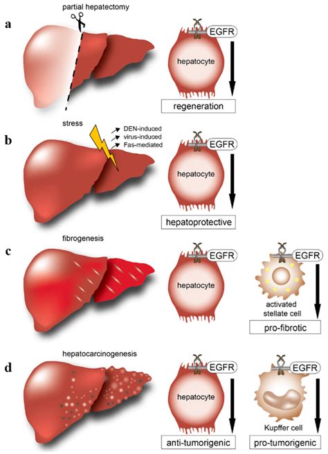 IJMS | Free Full-Text | EGFR Signaling in Liver Diseases