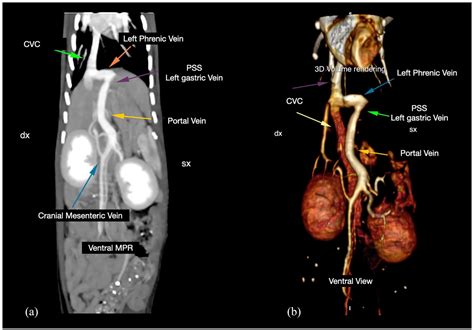 Laparoscopic portosystemic shunt attenuation in two cats