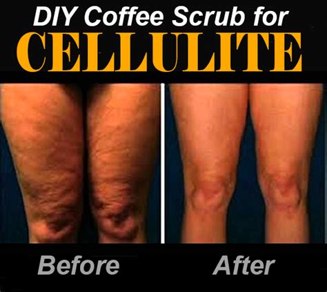 Review: Coffee Scrub for Cellulite Before and After - free natural beauty hacks and more!