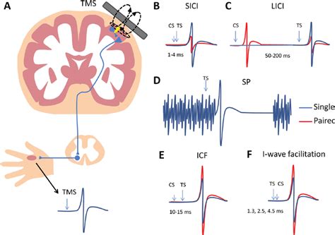 Transcranial magnetic stimulation (TMS) over motor cortex and TMS ...