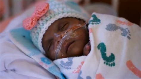 World’s Smallest Surviving Baby Born in San Diego – NBC10 Philadelphia