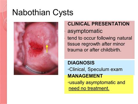 Cervical Cyst remedy - kurusteleonblog