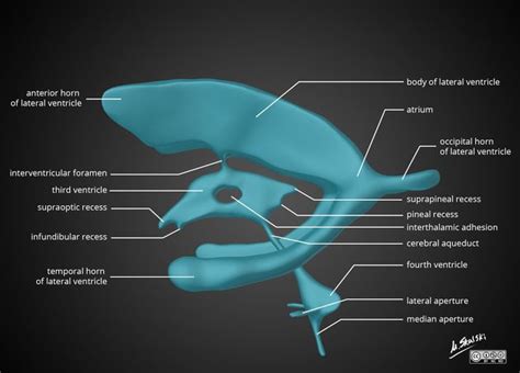 Interventricular foramen (of Monro) | Radiology Reference Article | Radiopaedia.org | Radiology ...