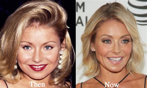 Kelly Ripa Plastic Surgery Before and After Photos - Latest Plastic ...