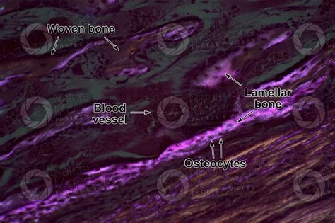 Woven Bone Histology