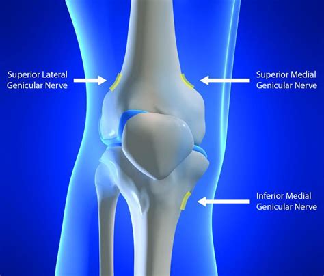 What is a Genicular Nerve Block and Why Would I Need One? – AIPM