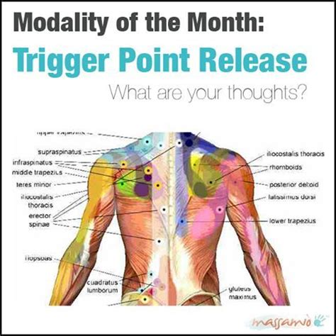 Log In or Sign Up to View | Massage therapy, Trigger points, Trigger point release