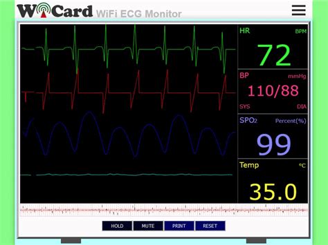 WiFi ECG Monitor With ESP32/ESP8266 and MAX30100 - WiCard