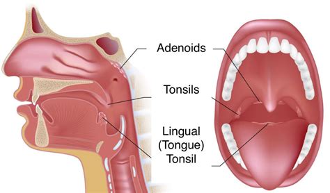 adenoids-and-tonslis - Pediatric Pulmonologists