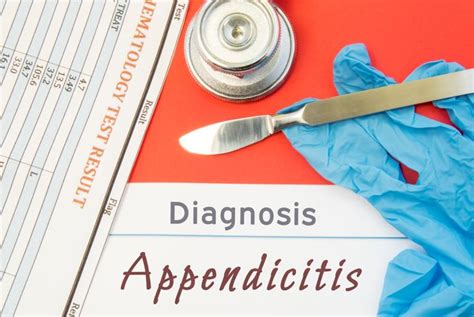 Epiploic Appendagitis Symptoms, Causes, and Prognosis - Health & Detox ...