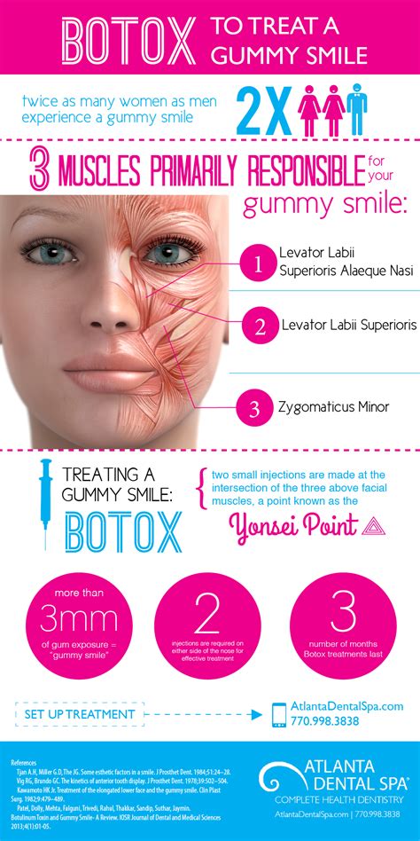 Botox in Atlanta | Atlanta Dental Spa | Gummy smile botox, Botox, Botox ...