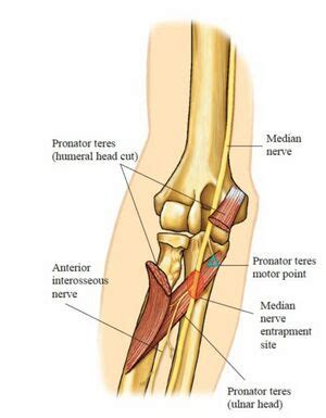 Pronator Teres - Physiopedia