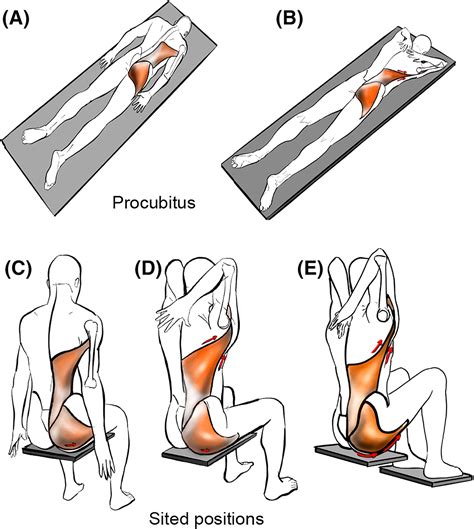 Influence of thoracolumbar fascia stretching on lumbar back muscle ...