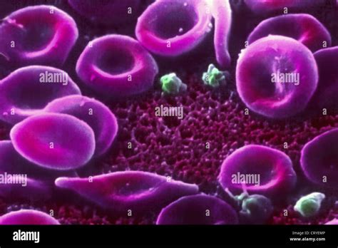 DREPANOCYTE Stock Photo - Alamy