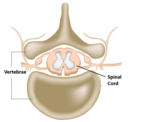 Cervical Whiplash - My Family Physio