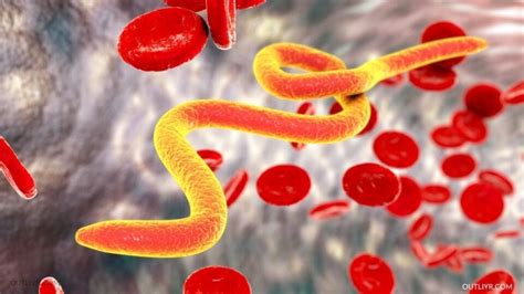 Potent Natural Ways To Kill Parasites FAST (Expert Protocol)