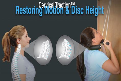 Pettibon Cervical Traction Unit | Backbone