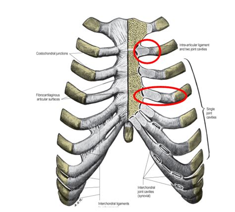 1st Costochondral Junction