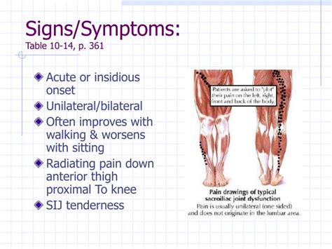 PPT - Sacroiliac Dysfunction PowerPoint Presentation - ID:270693