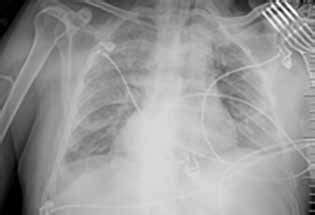 Standard chest radiography. | Download Scientific Diagram