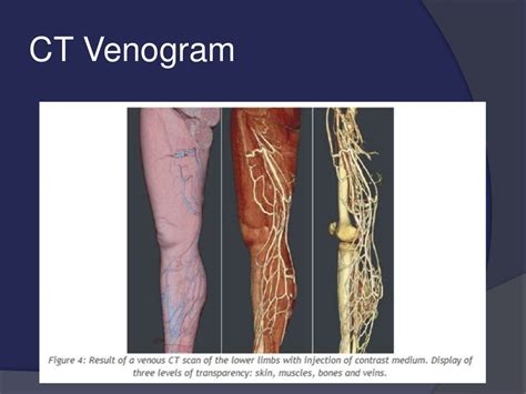 venous drainage of the lower limb