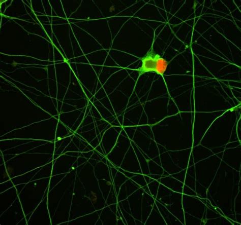 Retinoic acid (CAS 302-79-4): R&D Systems