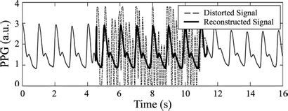 Frontiers | Photoplethysmogram Analysis and Applications: An Integrative Review